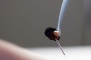 acupuncture needle with moxa smoke